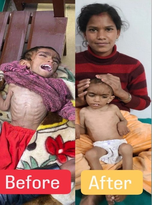 Ankit after recovery
